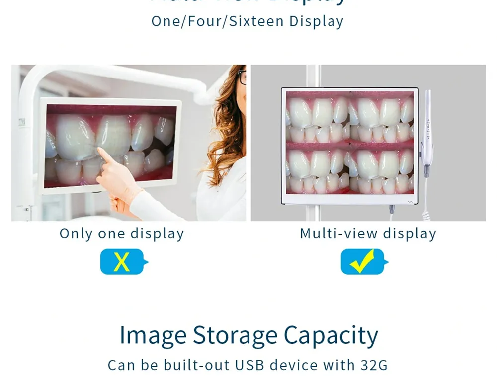 Intra Oral Camera View 3