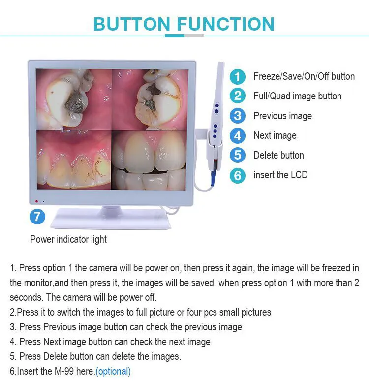 Intraoral Camera View 4