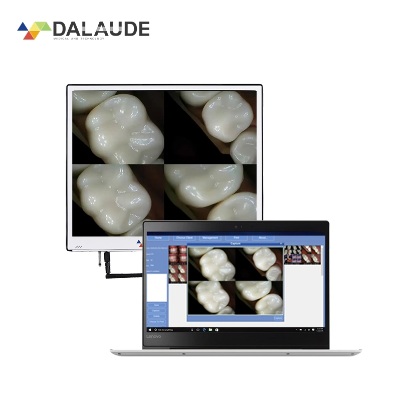 Factory Price Dental Intraoral Camera with HD Monitor