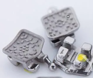 Orthodontic Detail 1