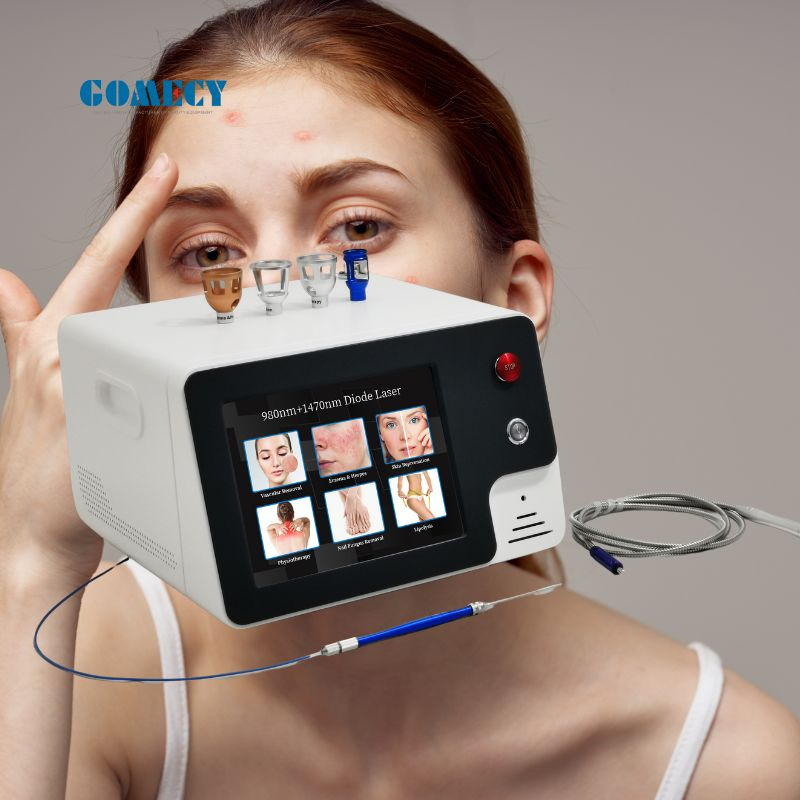2026 Professional Liposuction 600um for Body Liposuction Machine Laser Liposuction 1470nm Dental Use Endolaser Diode 1470