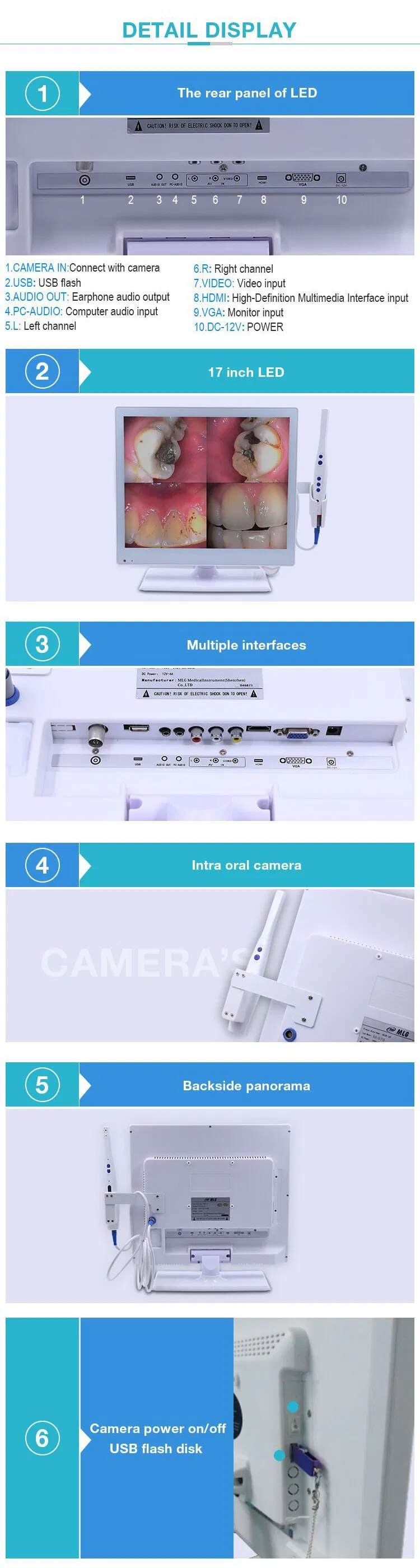 Intraoral Camera View 3