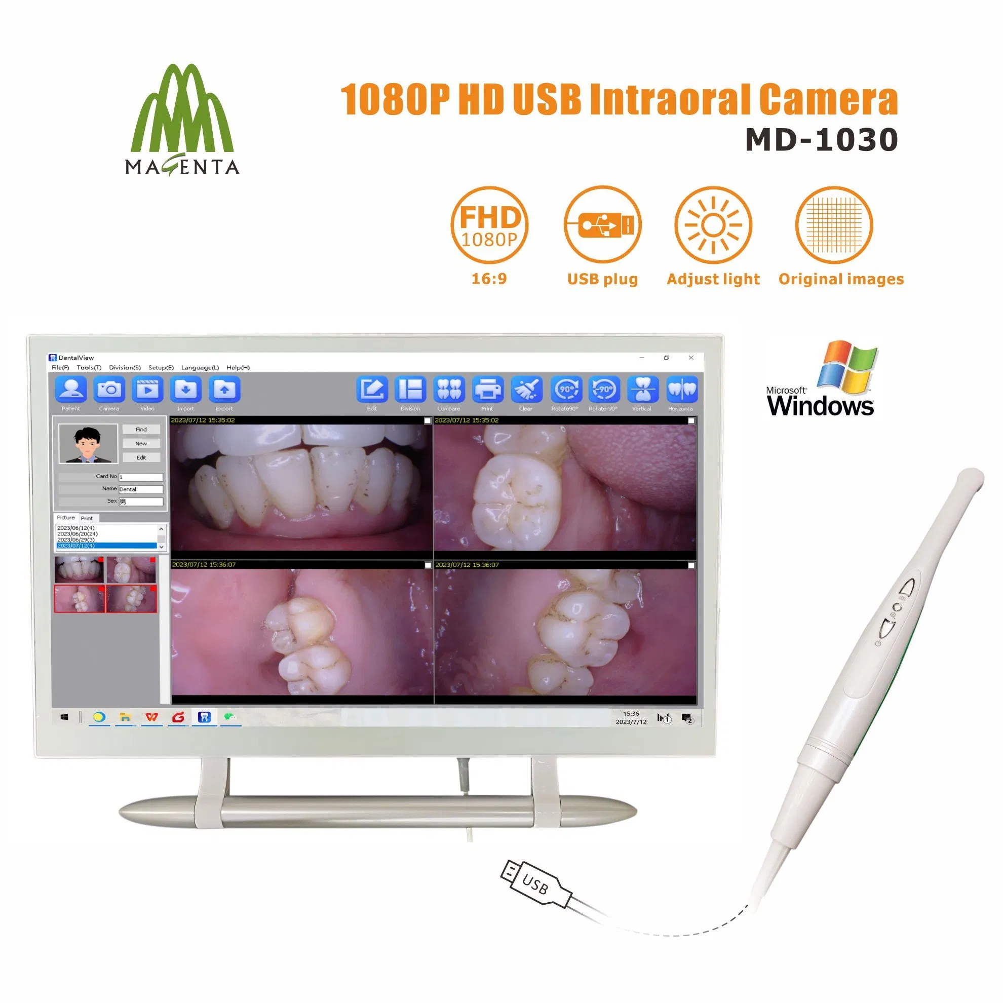 Magenta New USB Wire 1080P Intraoral Camera Factory Price Support Twain