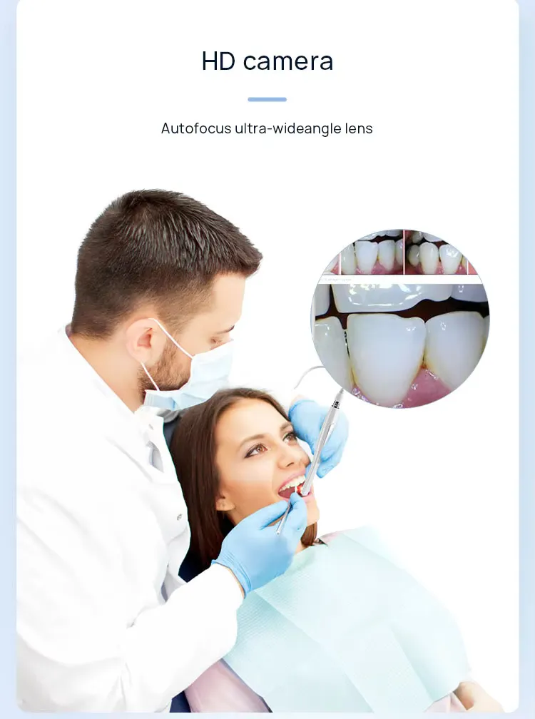 Intraoral Camera View 2