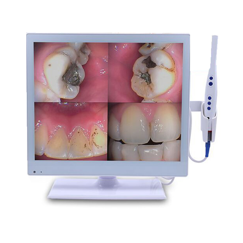 My-M067-1 Intra Oral Camera Medical Dental Equipment WiFi Wireless Intraoral Camera Dental