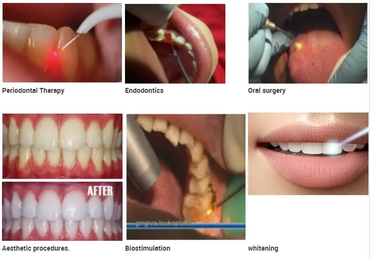 Dental Functions
