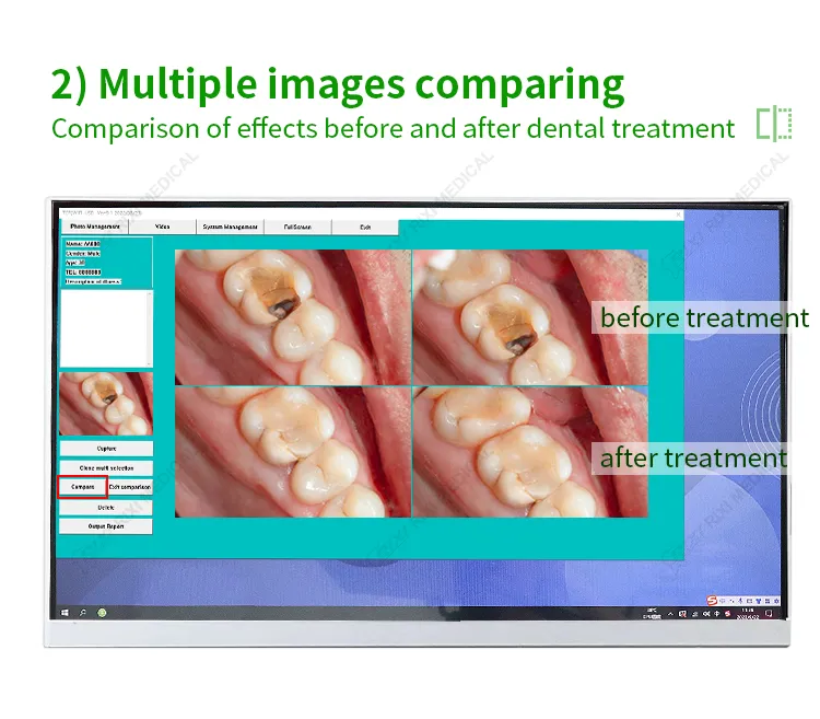 Advanced Equipment Detail 3