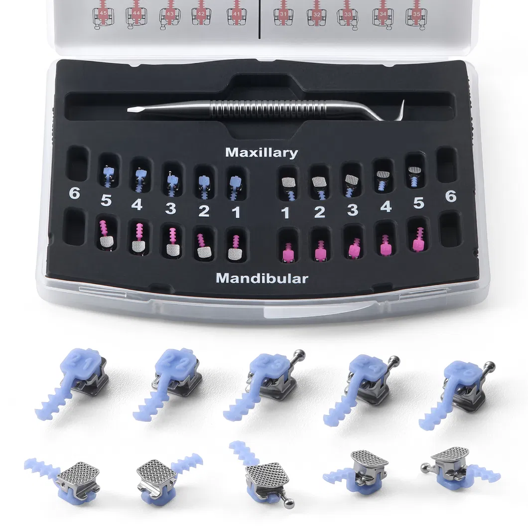 Orthodontic Self-Ligating Brackets