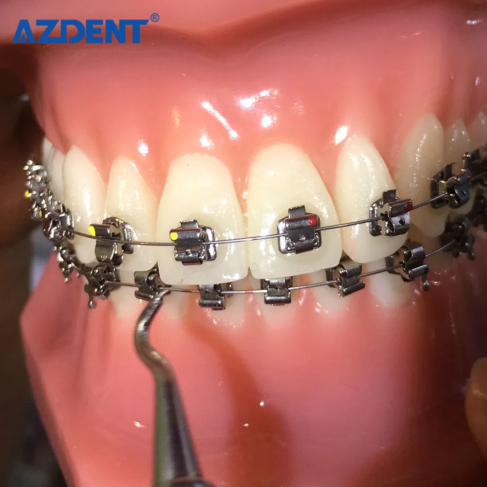 Orthodontic Brackets 7