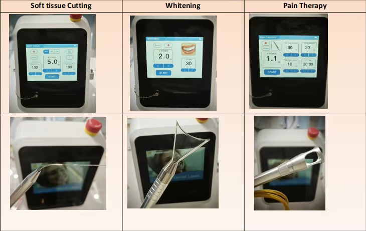 Soft Tissue 3 in 1 Diode Whitening Machine Dental Laser Device