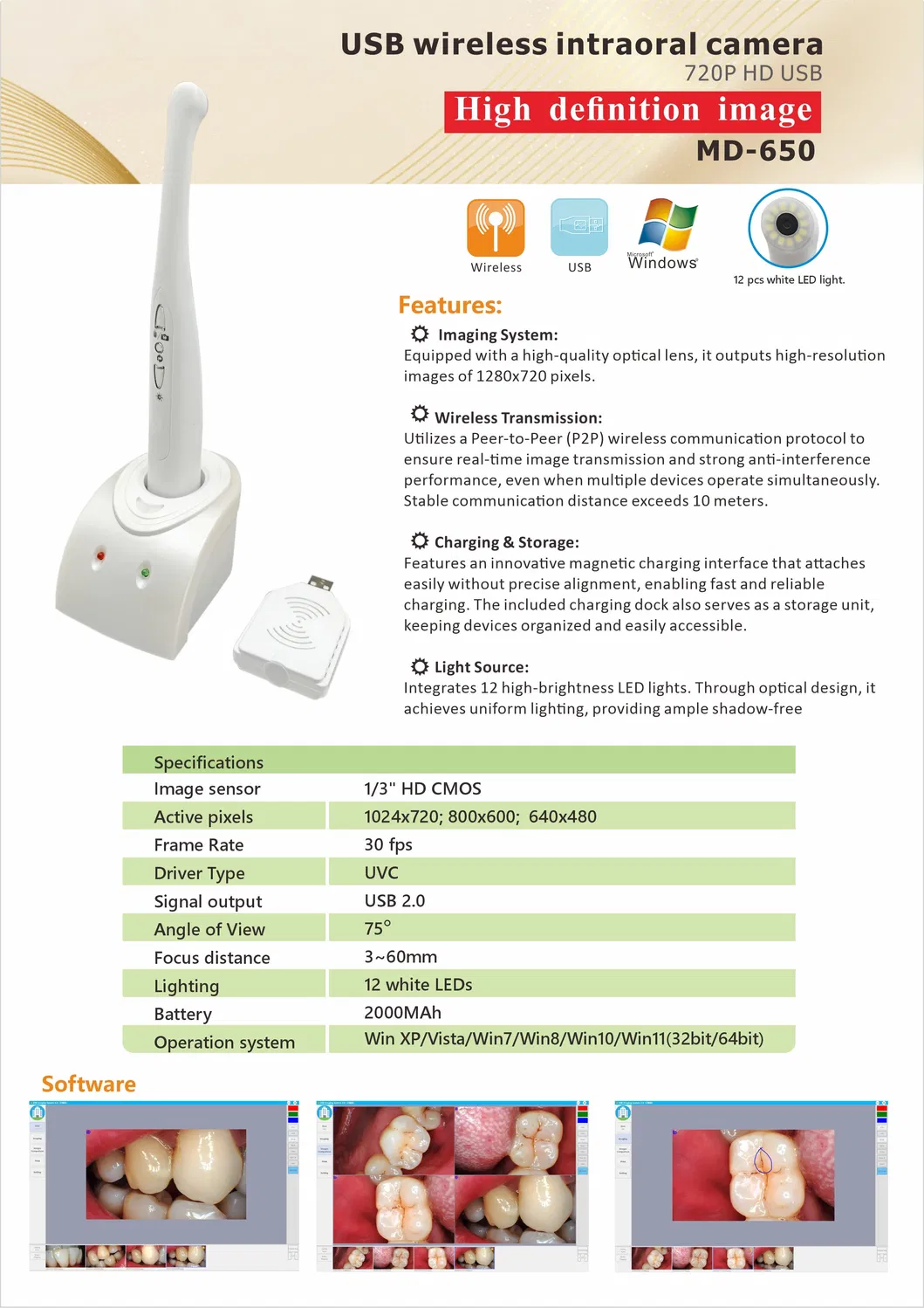 Wireless Dental Intraoral Camera