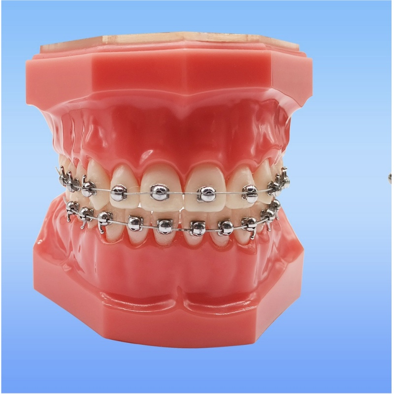 Round Ball Shape Dental Orthodontic Q Type Self-Ligating Bracket