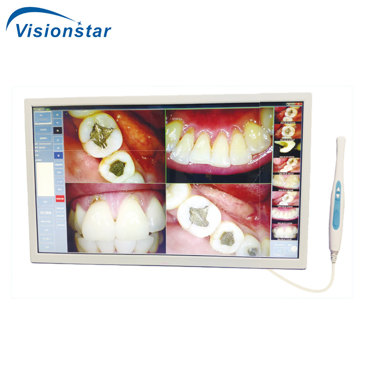Sjd-I960 Quality Wireless Digital USB Touch Screen Dental Intraoral Camera with Monitor for Dental Clinic