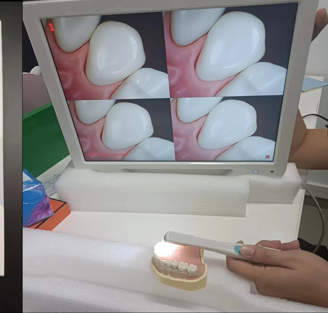 Advanced Laser Teeth Whitening Device with 1 Year Warranty Included