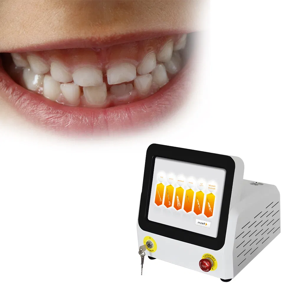 Hot Sale Portable 980nm 30W 60W Dental Soft Tissue Laser Therapy Hard Tissue Whitening Dental Laser Device