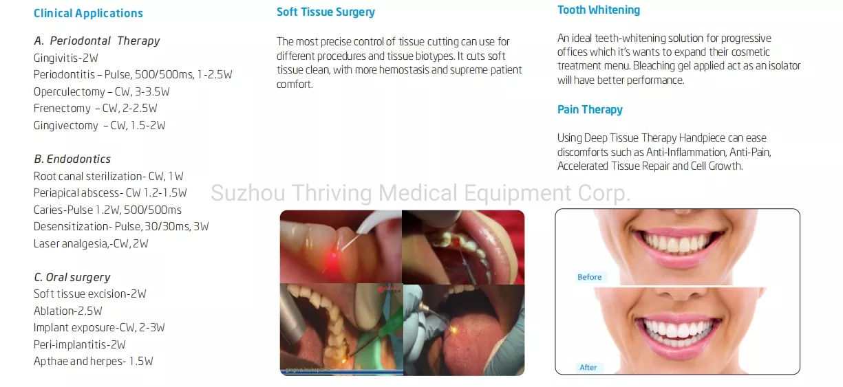 Cheapest Medical 810nm/940nm/980nm Dental Diode Laser Dental Treatment Equipment