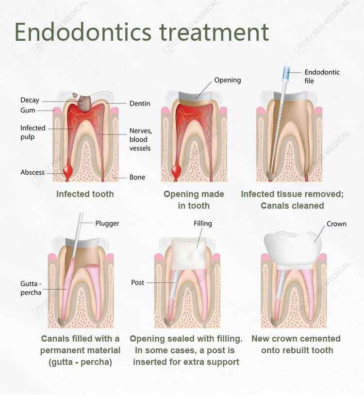Rotary File Detail 6