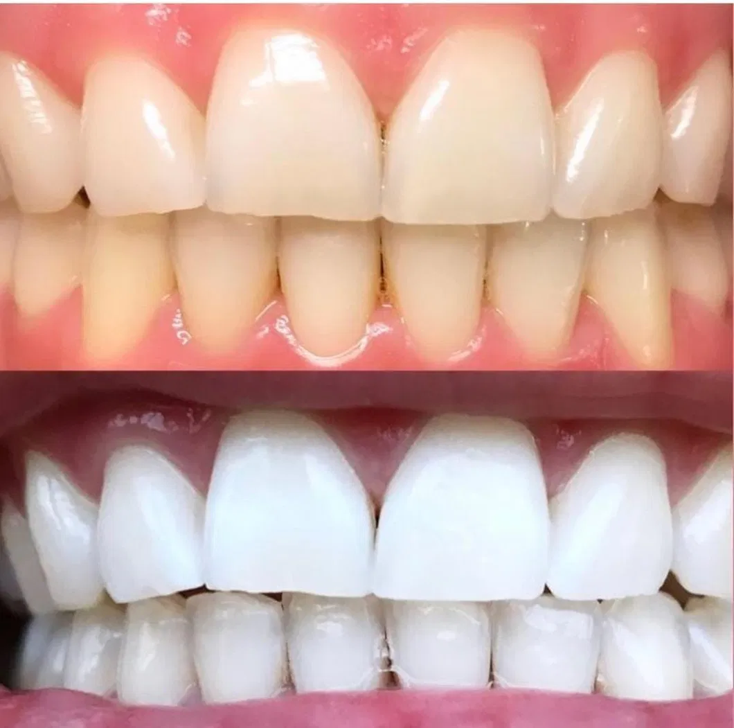 Before and After Results