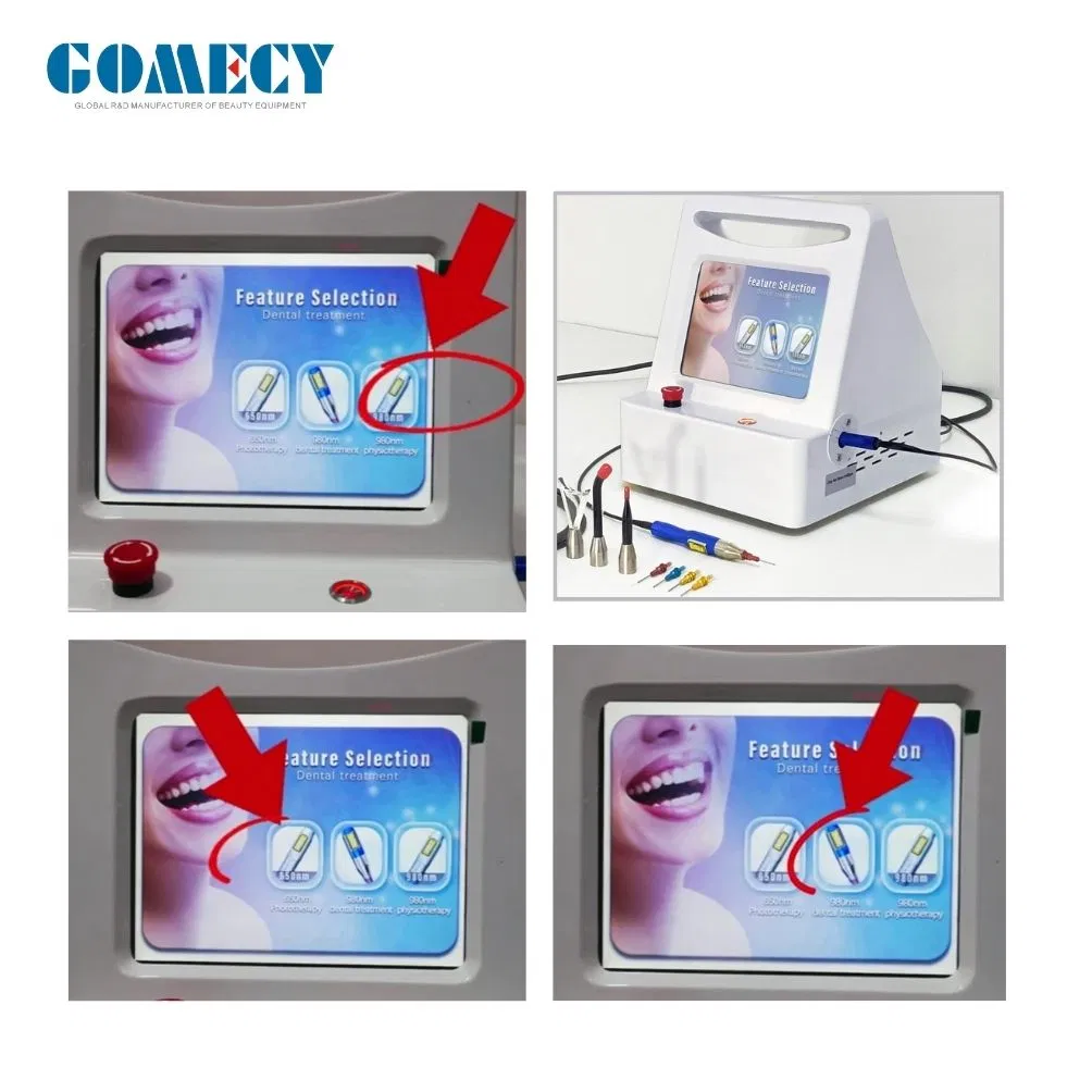 Gomecy Medical Level Dental Clinic Use Wisdom Teeth Pain Relief Tooth Whitening Device
