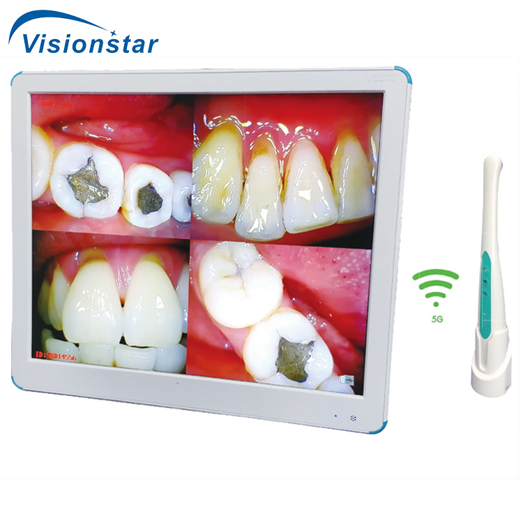 Sjd-I960 Quality Wireless Digital USB Touch Screen Dental Intraoral Camera with Monitor for Dental Clinic