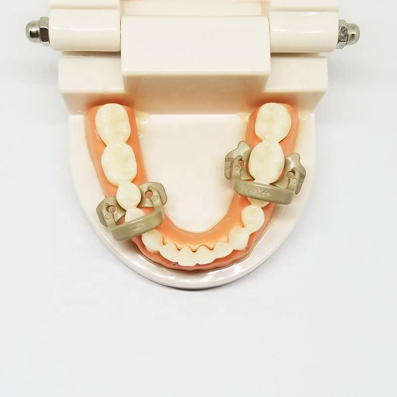 SJ High quality surgical instruments black dental rubber dam clamps kit