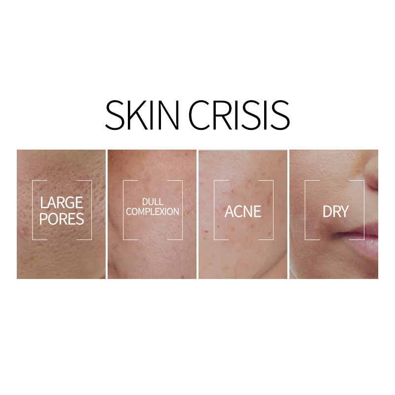 2023 Hot Selling Anti-aging Moisturizing Vitamin C Facial Whitening Serum