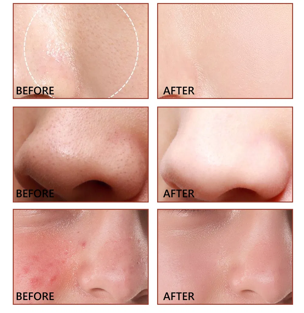Pore Minimizer Face Serum Multi-Step Solution for Shrinking Pores, Cleansing, Oil Control Serum