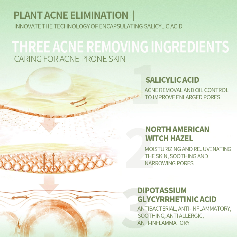 Acne Serum 6