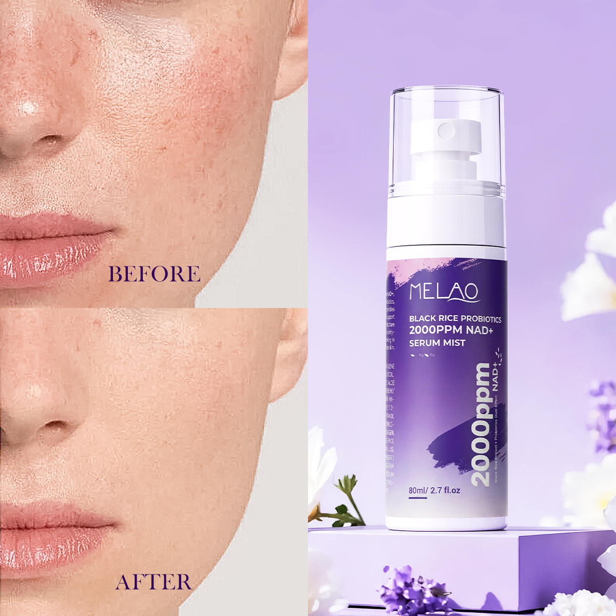 OEM Black Rice Probiotics 2% NAD+ Ultra-Fine Mist Serum Hydrating Plumping Barrier Repair Sensitive Skin Ceramide Skincare Vegan
