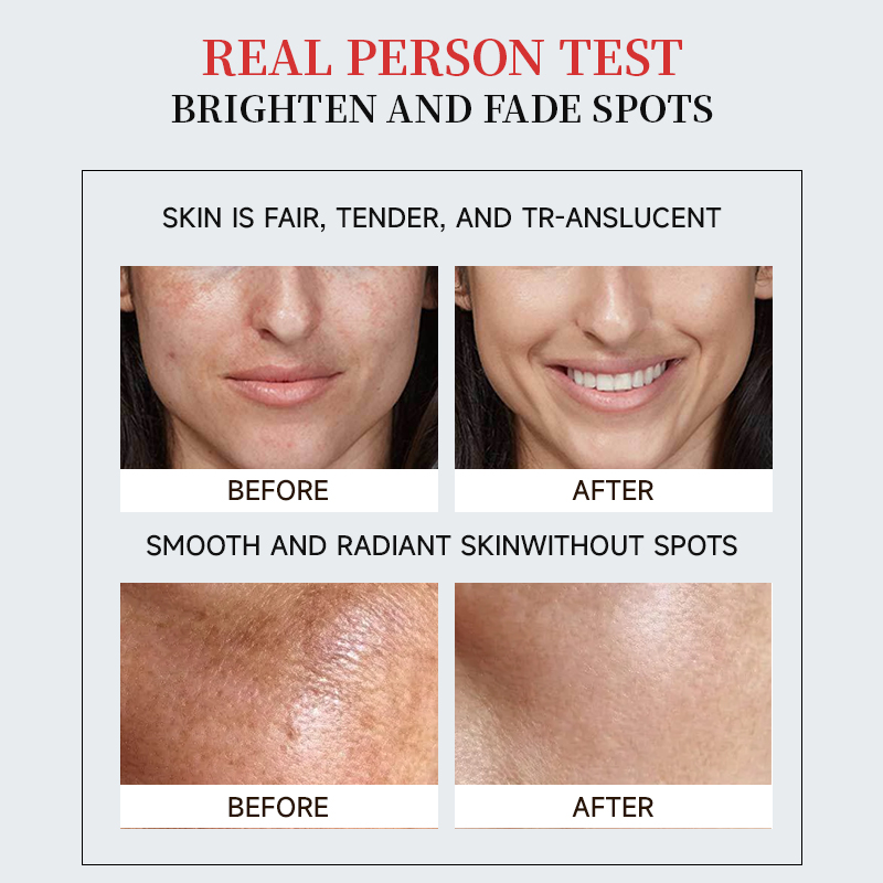Factory Wholesale Dark Spot Remover Facial Serum Brightening Dark Spot Correcting Glow Serum