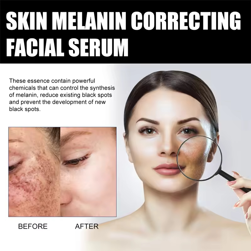 Private Label Body Melanin Correction Serum Moisturizing Firming Brightening Pigmentation Reducing Black Spot Fading Home Use