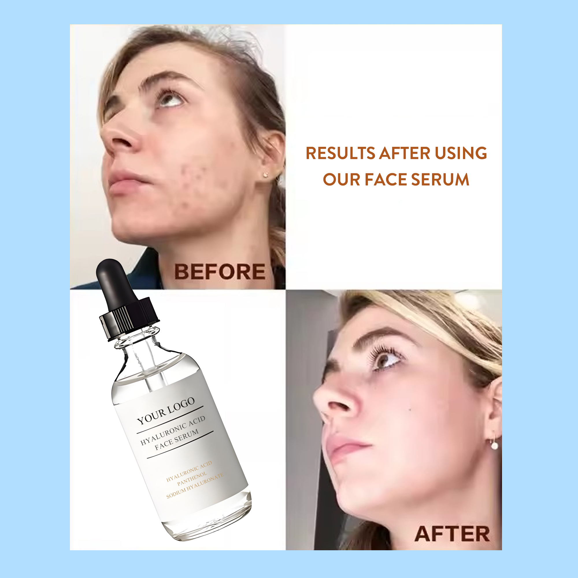 OEM/ODM Hyaluronic Acid B5 Vitamin Serum Custom logo 30ml Lightening Face Serum for Skin Barrier Repair & Moisturizing Wholesale