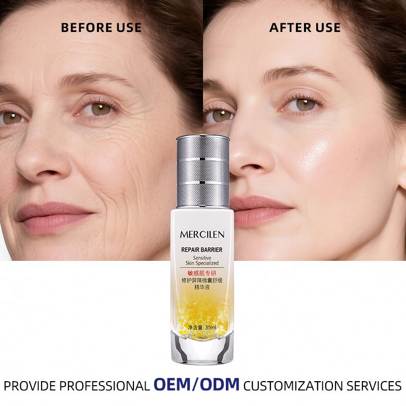 OEM/ODM Barrier Soothing Serum Vitamin E Collagen Arbutin Herbal Hot Sales Sensitive Anti-Wrinkle Facial Skin Soothing Serum