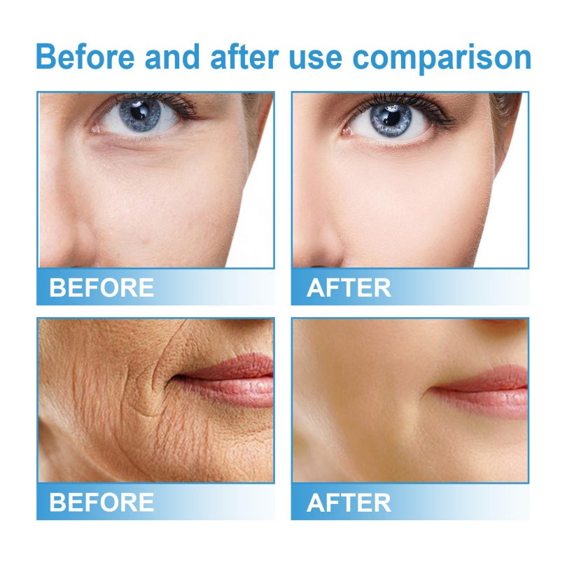 Oil-Control Hypoallergenic Natural ODM OEM Skin Care Face Serum for Facial Radiance