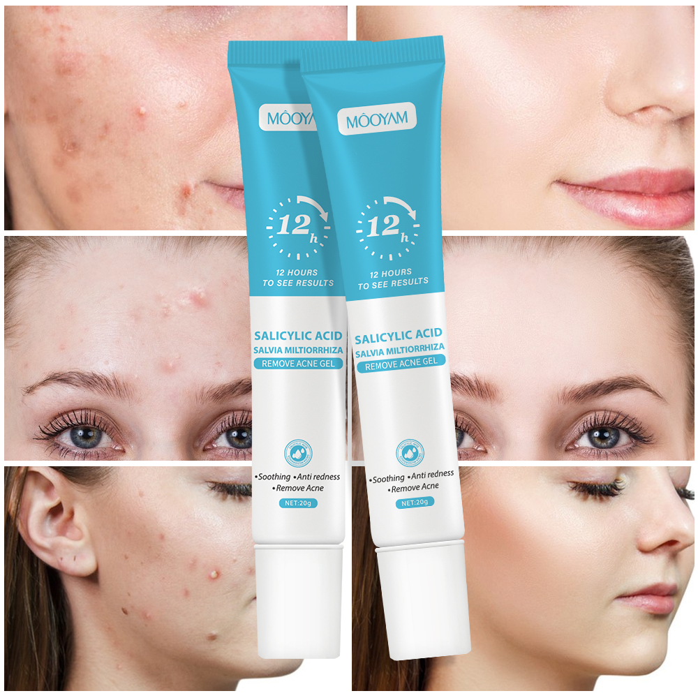 Fast Effective Repair Pimple Scar Anti Spots Removal Collagen Gel Moisturizing Anti-Wrinkle Smooth Skin Shrink Pores Treatment
