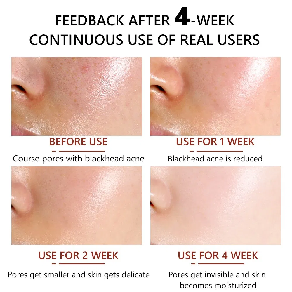 Pore Minimizer Face Serum Multi-Step Solution for Shrinking Pores, Cleansing, Oil Control Serum