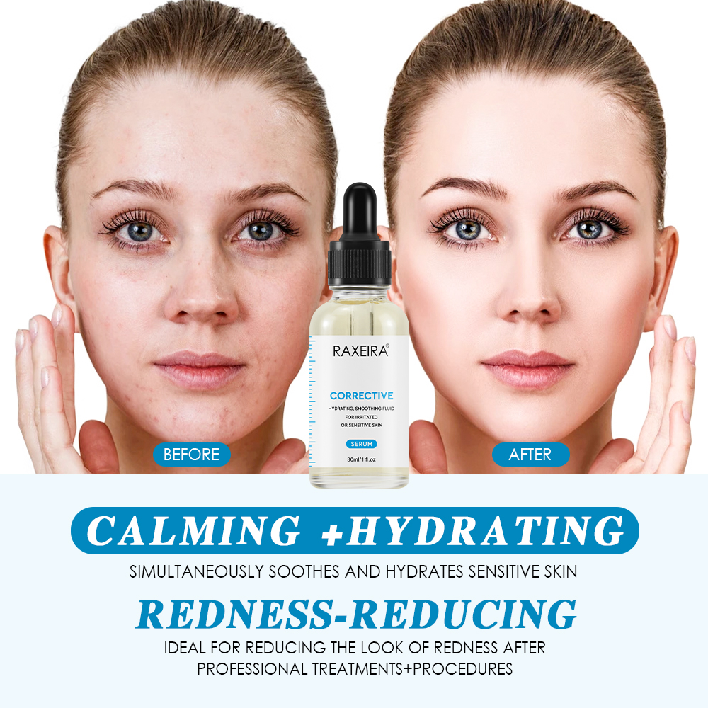 Corrector Pigment Dark Spot Serum Anti Acne Removing Facial Correcting Glow Dark Spot Corrector Face Serum Whitening Skin