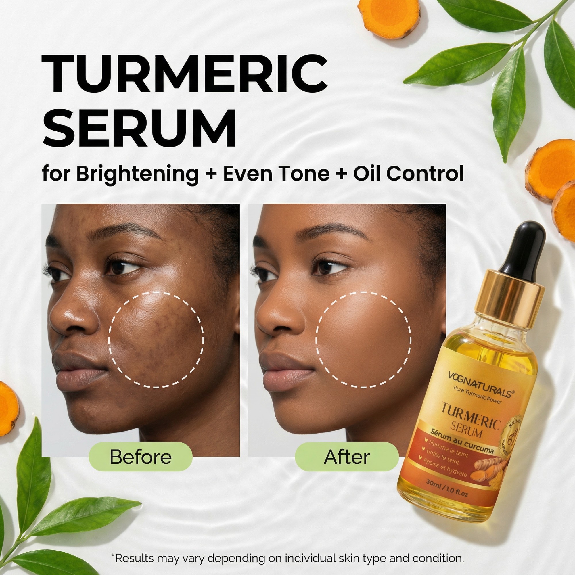 Night Hydrating Private Label Brightening Turmeric Skin Care Removing Black Spot Remover Turmeric Face Serum for Dark Spots