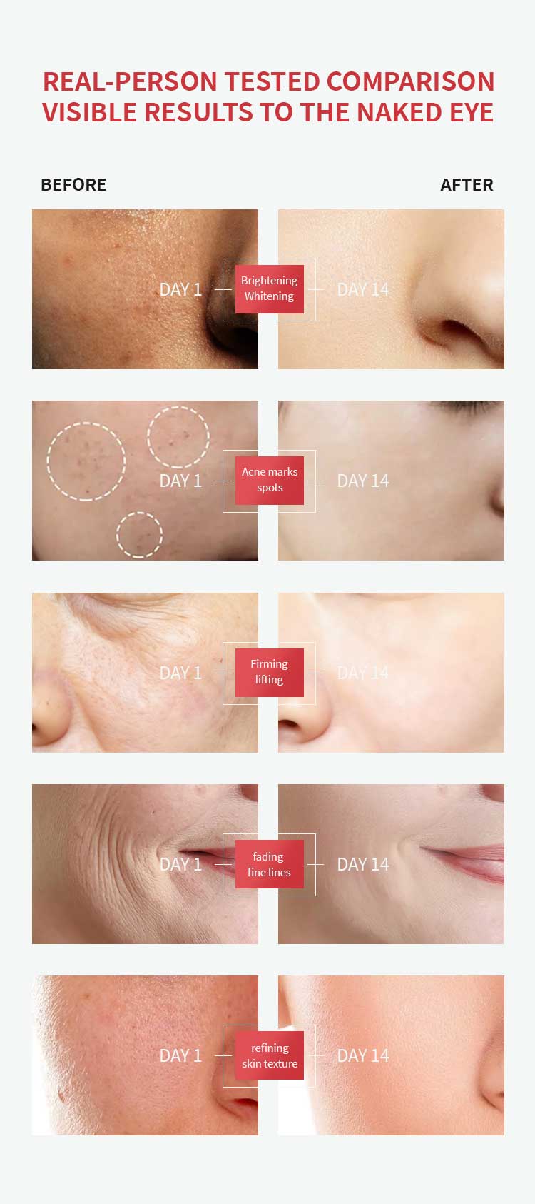 B3 Retinol serum