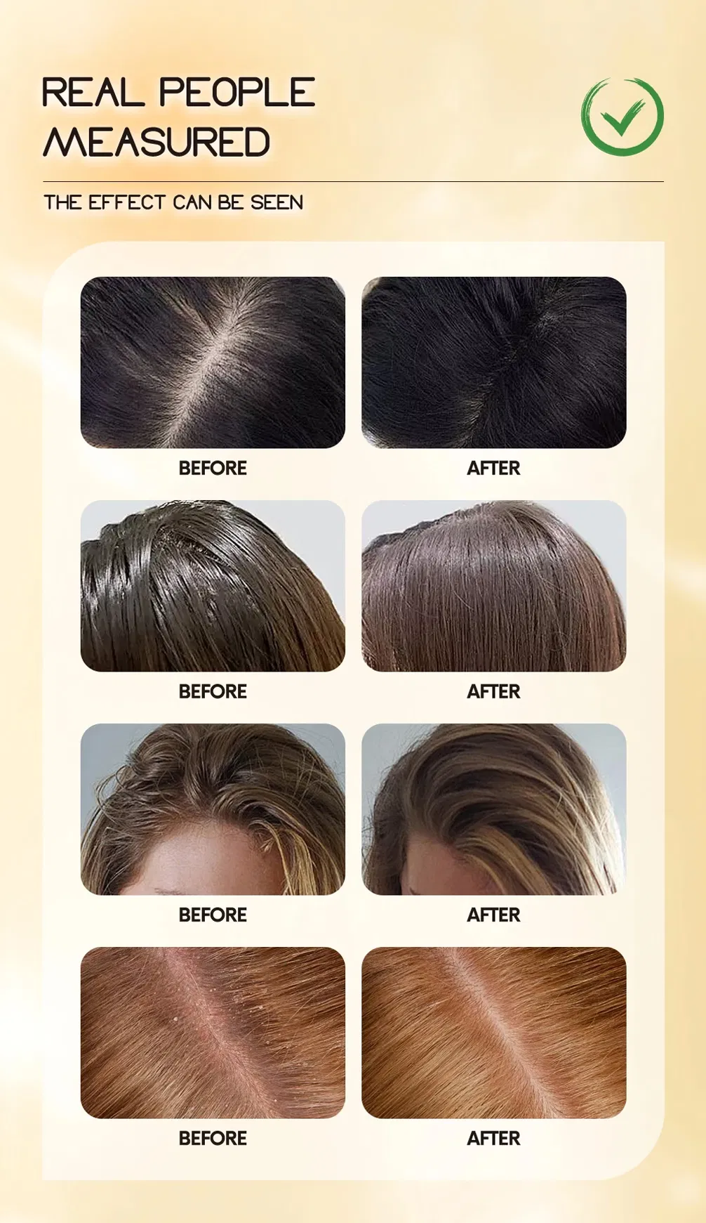 Hair Treatment 7
