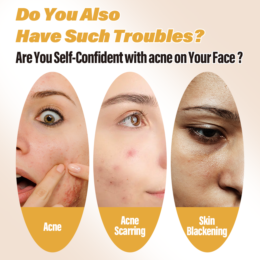 Custom Bodylife Oem Odm Acid Salicylic Acid Serum Private Label Skin Repairing Face Anti Acne Treatment Toner