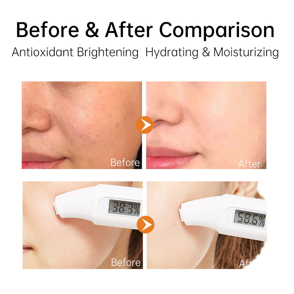 10% Vitamin C Ethyl Ascorbic Acid Serum Brightening Anti-Aging Dark Spot Removing Hydrating Hyaluronic Acid Face Serum OEM/ODM