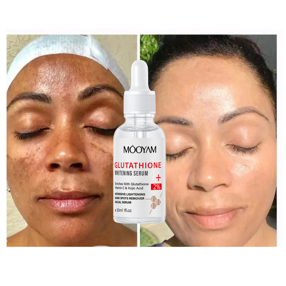 OEM Strong Whitening Capsule Corrector Antioxidants Anti-Aging Moisturizer Remove Melasma Improve Skin Firmness WHITE SERUM