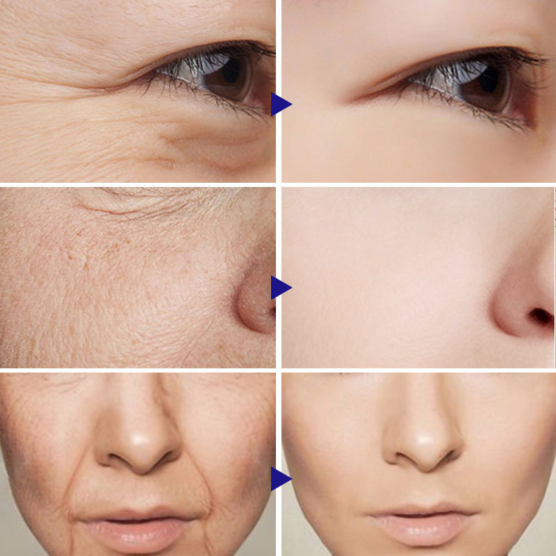 2023 Hot Selling Anti-aging Moisturizing Vitamin C Facial Whitening Serum