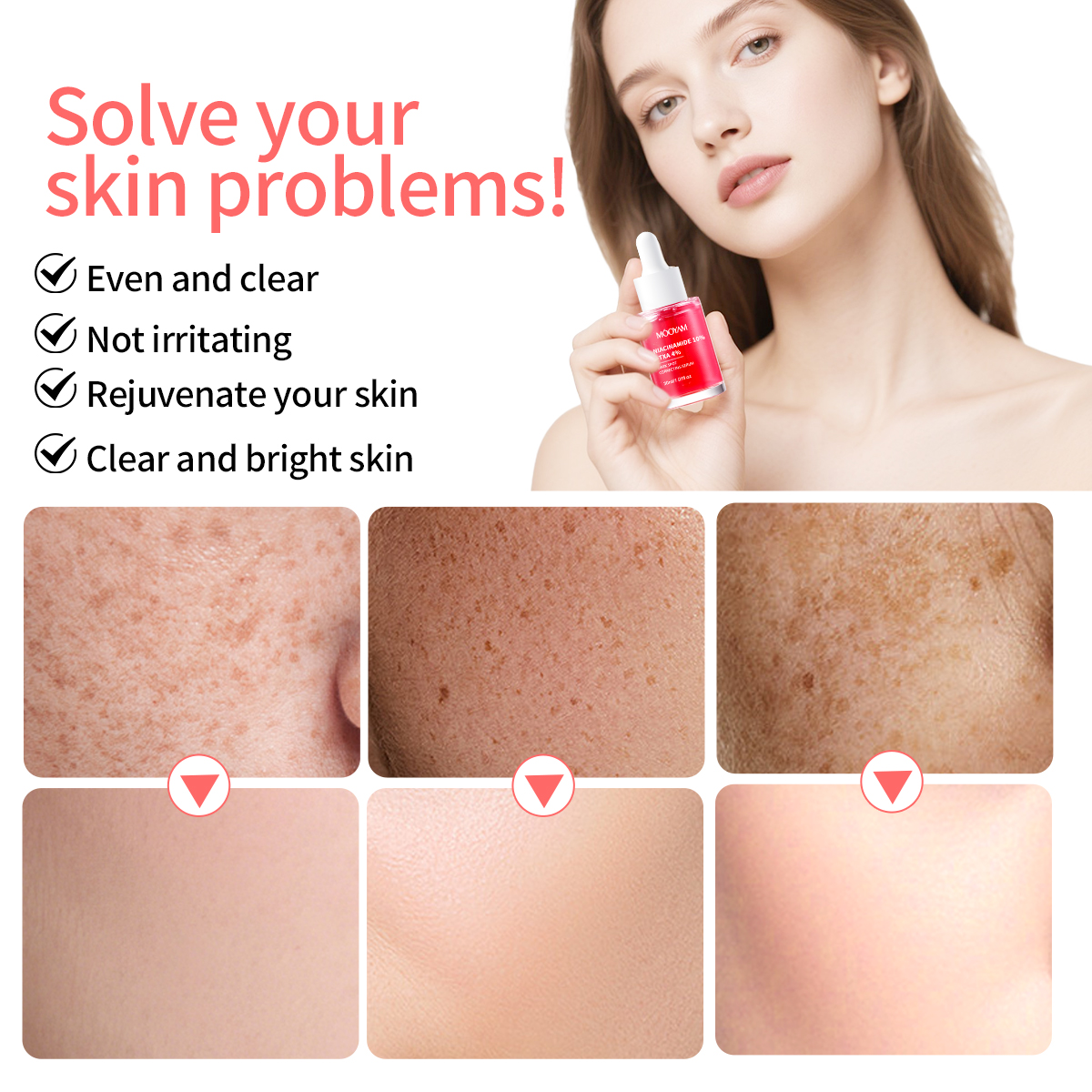 OEM Niacinamide 10%+Txa 4% Dark Spot Correcting Serum Pore -shrimkimg Anti- Aging And Brightening 30ml MOOYAM Facial Serum