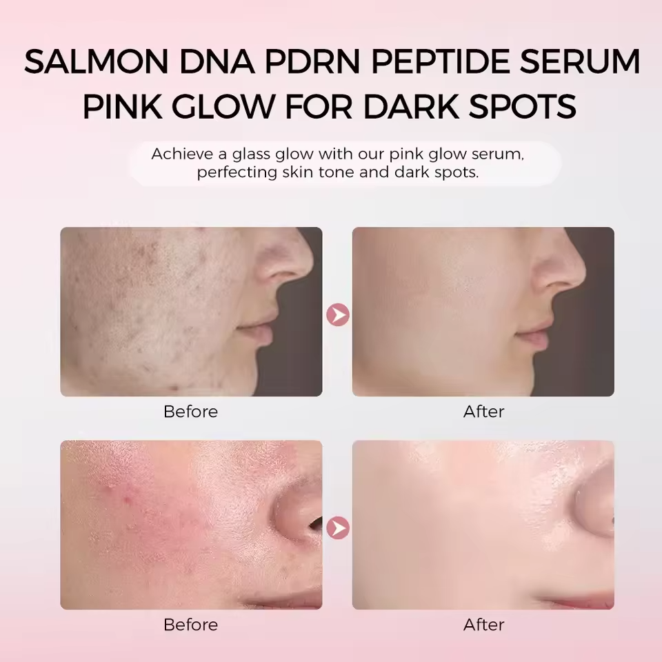 Korean Hydrating Firming Skin Care Pink Peptide Niacinamide Astaxanthin-Centella Radiance for Serum Moisturizer Whitening