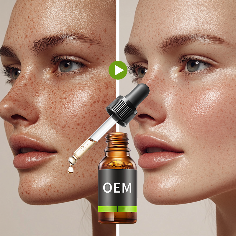 OEM Custom Whitening Serum Brighten Skin Tone Fade Spots Rejuvenation Arbutin Niacinamide Vitamin c Whitening Essence