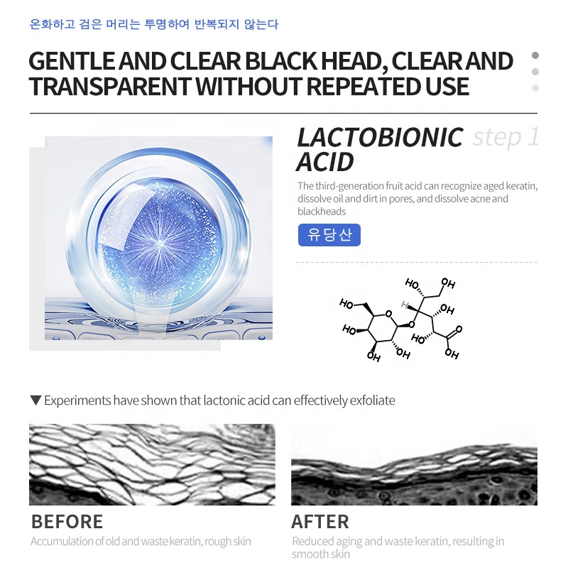 Skin Care Fruit Acid Pore Minimizer Blackhead &amp; Pimple Extractor Anti Acne Treatment Blackhead Remover Serum