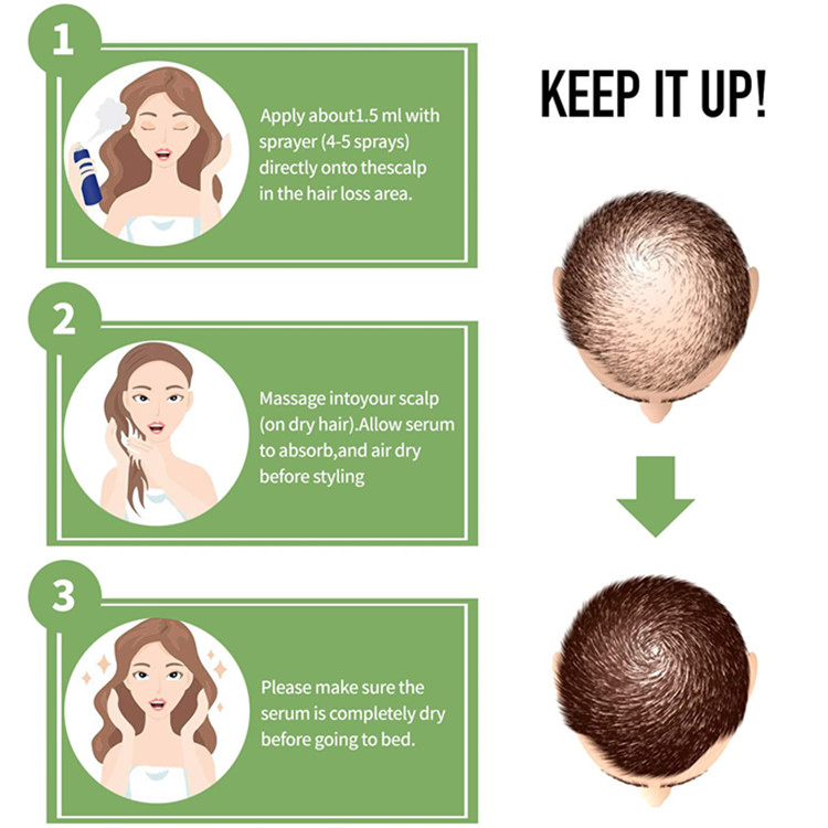 Advanced Topical Formula Custom Hair Growth Serum for Thicker &amp; Healthier Hair