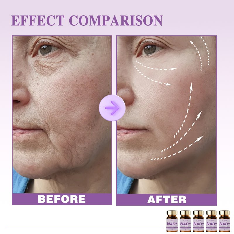 Customized Logo Nad+ Lifting Solution Firming Skin Facial Lifting Serum Smooth Fine Lines &amp; Lmprove Firmness Face Serum